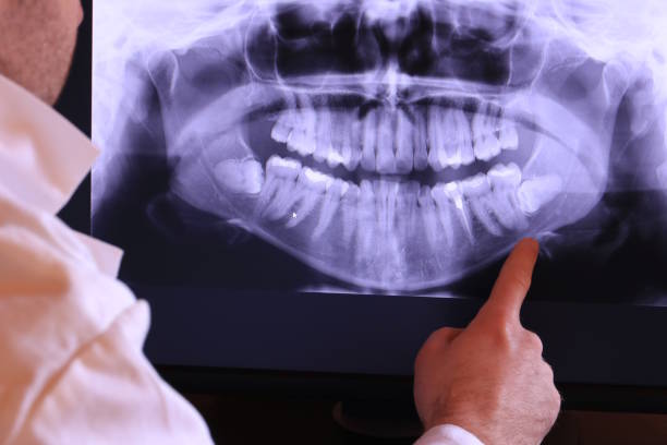 Best Emergency Root Canal Treatment in Marine, IL
