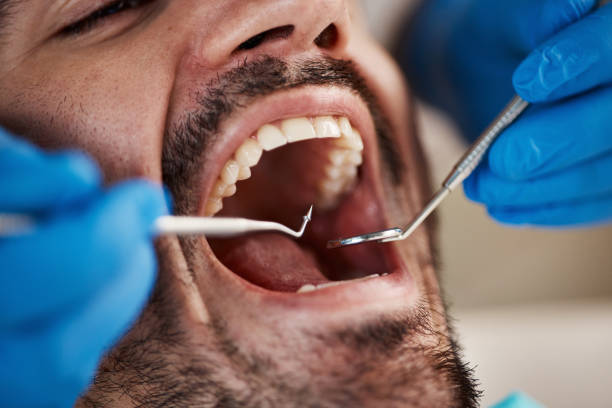 Best 24-Hour Emergency Dentist in Marine, IL