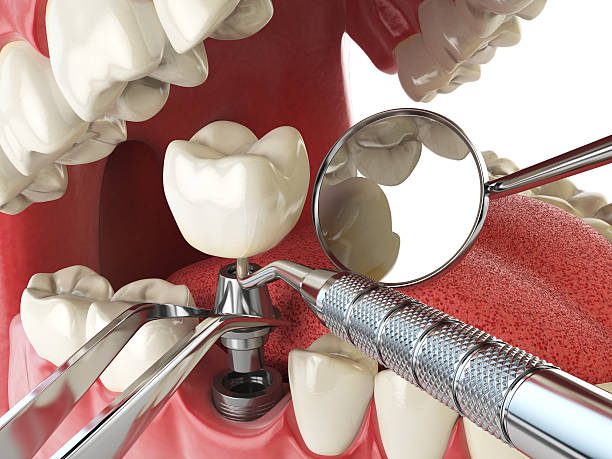 Best Emergency Dental Services for Seniors in Marine, IL