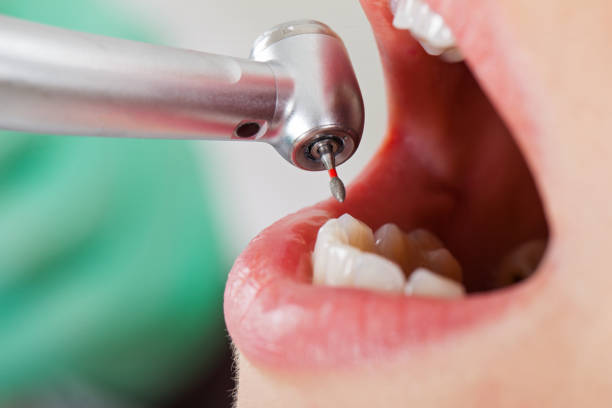 Best Holiday Emergency Dentist in Marine, IL